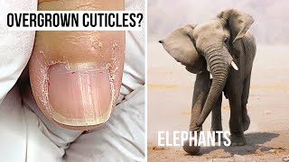 What Do Elephants amp Overgrown Cuticles Have In Common [upl. by Anire]