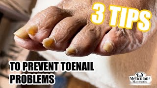 3 Pedicure Tips to Restore Preserve and Prevent Toenail Problems [upl. by Maddox]