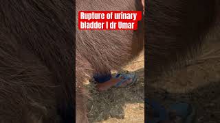 Rupture of urinary bladder l Retention of urinary bladder l dr Umar khan [upl. by Gregor]