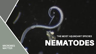 Nematodes  the most abundant multicellular species  under the microscope [upl. by Reddin144]