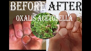 How villagers clean the stain on the nails OXALIS ACETOSELLA [upl. by Rehctelf]