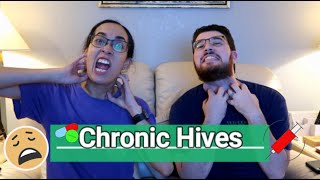 🤒Chronic Hives🌡  Understanding the condition🩺 [upl. by Ban21]