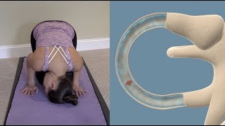 Half Somersault Maneuver to Treat BPPV Vertigo [upl. by Assirt]