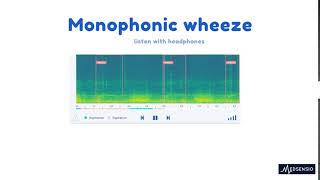 Lung sounds  monophonic wheeze [upl. by Baelbeer]