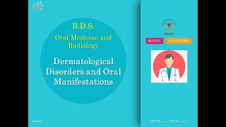 Dermatological Disorders and Oral Manifestations  Oral Medicine and Radiology  BDS  00845  PPT [upl. by Yelkrab]