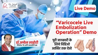 Understanding Varicocele Treatment  Angiography amp Wire Placement in Embolization  Dr Amol Lahoti [upl. by Attener489]