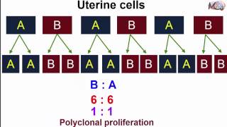 Pathology  Monoclonal amp Polyclonal   Dr Mahmoud Saeed [upl. by Aiceila]