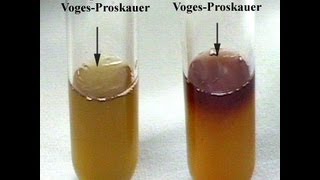 VogesProskauer Test  Amrita University [upl. by Dichy88]