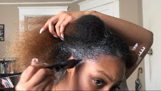 Grow Back HAIR AND EDGES FAST  Monistat 7 Scalp Treatment for Hair Growth [upl. by Suirada]