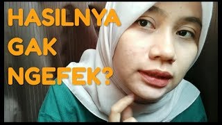 REVIEW HASIL PEELING ACNE DI ERHA CLINIC SUKABUMI [upl. by Martainn]