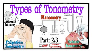 Tonometry All Types of Tonometry 23 [upl. by Nyla703]