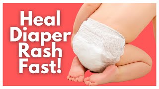 Ultimate Diaper Rash Guide  Tips For Tough Diaper Rashes [upl. by Esdras]