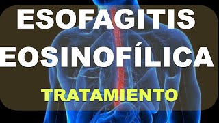 Tratamiento de la Esofagitis Eosinofílica [upl. by Ada]