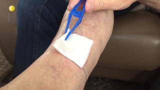 Treatment of a wound using LMesitran Tulle [upl. by Sutphin]