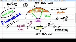 Sling surgeries  Concept Purandare and Shirodkars [upl. by Pihc]