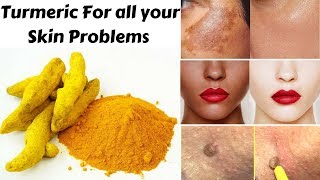 Top 3 Ways To Use Turmeric For Skin Pigmentation Skin Whitening amp Skin Tags  Home Remedies [upl. by Leirbag987]