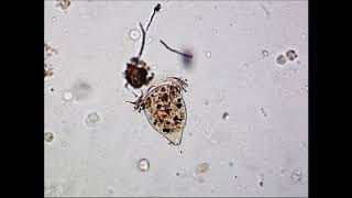 Free Swimming Vorticella Ciliate Protozoa [upl. by Pepe]