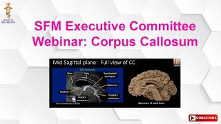 SFM Executive Committee Webinar Corpus Callosum [upl. by Housen]