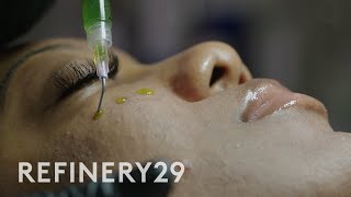 I Tried a Chemical Peel for Glass Skin BioRePeel  Macro Beauty  Refinery29 [upl. by Sachsse392]