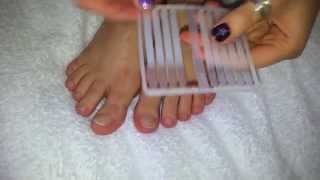 How to treat TOENAILS FUNGUS [upl. by Muhcon]