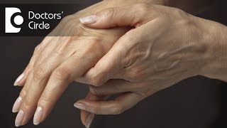 Role of homeopathy in treating Rheumatoid Arthritis  Dr Surekha Tiwari [upl. by Namajneb441]