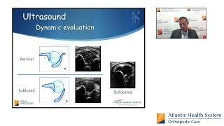 Development Dysplasia of Hip Evaluation and Screening Protocols [upl. by Ahsitra8]