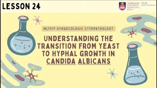 Understanding The Transition From Yeast To Hyphal Growth In Candida Albicans [upl. by Agemo]