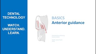 Anterior Guidance  How anteriors guide lower jaw movements [upl. by Gottuard]