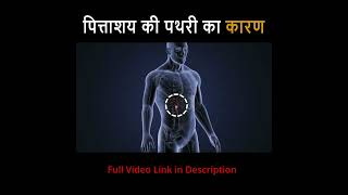 पित्त पथरी क्यों और किसे होती है   Gallbladder Stone Cause  OJ Amritam [upl. by Leahkim]