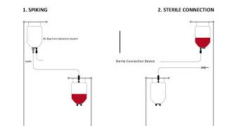 Establishing Sterile Conenction With UVA PIT System [upl. by Mcnair49]