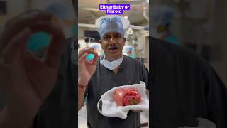 Either Baby or Fibroid  pregnant baby fibroidremoval babybirth uterus 8yearwait [upl. by Prowel]