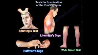 Tests For Examination Of The Cervical Spine  Everything You Need To Know  Dr Nabil Ebraheim [upl. by Oirtemed]