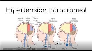 Aumento de la PIC  Edema cerebral Hidrocefalia Hernias cerebrales  FISIOPATOLOGÍA [upl. by Ralleigh]