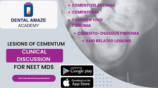 Clinical Discussions Lesions of cementum amp related lesions For NEET MDS [upl. by Ivo]