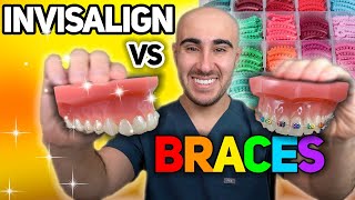 Braces vs Invisalign Cost Tooth Pain Speed etc  The ULTIMATE Review 🔥 [upl. by Huff839]