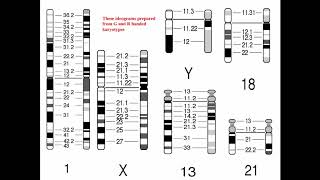 Cytogenetics II Chromosome Analysis amp Karyotypes [upl. by Aleunamme]