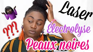 Epilation définitive du visage la méthode la plus efficace  Revue complète sur lélectrolyse [upl. by Wendie]