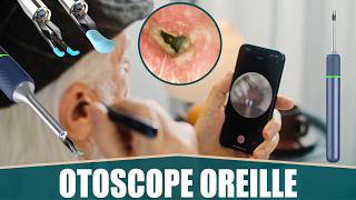 LE MEILLEUR OTOSCOPE CAMÉRA OREILLE  VLIKE [upl. by Iaverne]