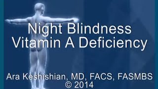 Night Blindness  Vitamin A Deficiency [upl. by Georgeanna]