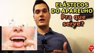 Elástico do aparelho para que serve [upl. by Cece]