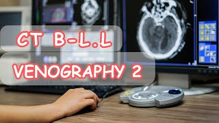 Ct venography reconstructionتقطيع واعادة بناء صور أوردة الطرفين السفليين [upl. by Llewxam]