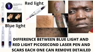 DIFFERENCE BETWEEN BLUE LIGHT AND RED LIGHT PICOSECOND LASER PEN AND THE SCARS THEY CLEAR [upl. by Maclaine]