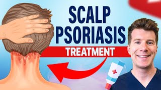 Doctor explains FOUR TREATMENTS for SCALP PSORIASIS [upl. by Ainnat722]