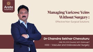 Is it possible to treat Varicose Veins Without Surgery  Dr Chandra Sekhar Chevuturu varicoseveins [upl. by Tsan44]