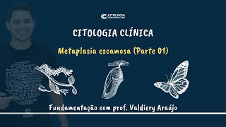 Fundamentos da Citologia Clínica metaplasia escamosa parte 1 [upl. by Normandy]