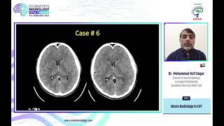 Emirates Neurology Virtual Congress 46 February 2021  Dr Mohammed Asif Dogar [upl. by Aisekal]