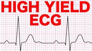 Electrocardiograms ECG Made Easy [upl. by Ahsikin]