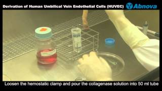 Derivation of Human Umbilical Vein Endothelial Cells HUVEC [upl. by Oicnedif]