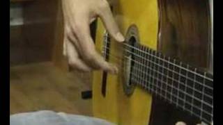 1Flamenco guitarist and focal hand dystonia Distonía focal [upl. by Atekihc]