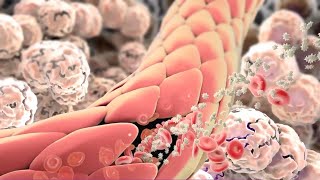 Inflammation Immune Response to Tissue Injury or Infection [upl. by Hepza]